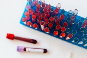 Enfermería de laboratorio de sangre: El proceso de donación y análisis de la sangre